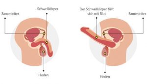 wie entsteht ein erektionsproblem